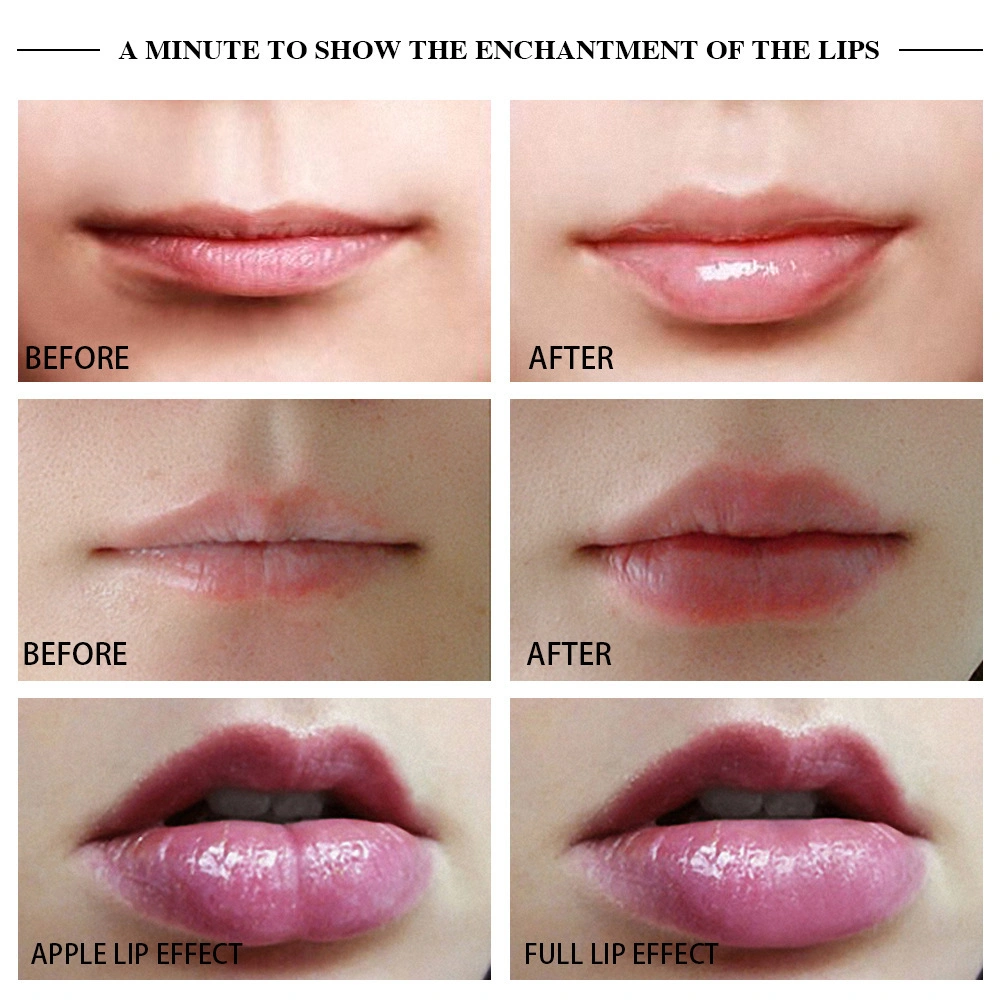 Lip Augmenter Electric Silikon Lip Plumper Device USB Vibrating Lip Optimierungstool