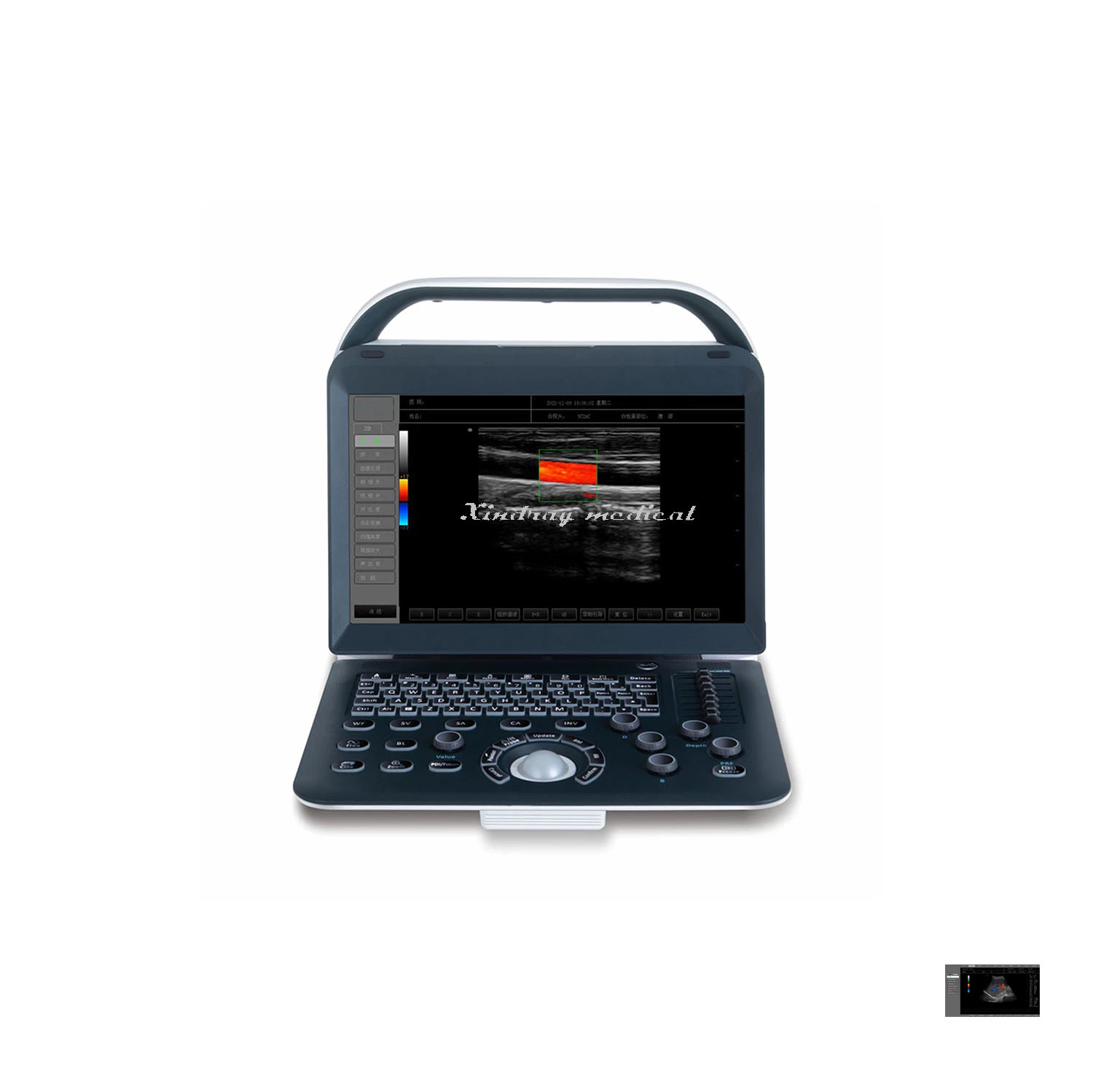 Ultrasound Machine Laptop Portable Color Doppler Ultrasound Scanner with Best Price