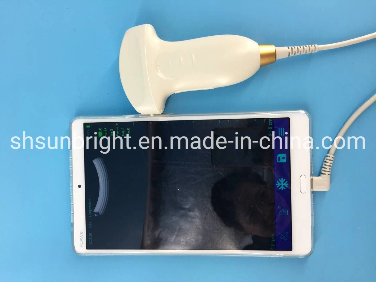 New Coming USB Ultrasound Probe Wireless Convex Probe Ultrasound