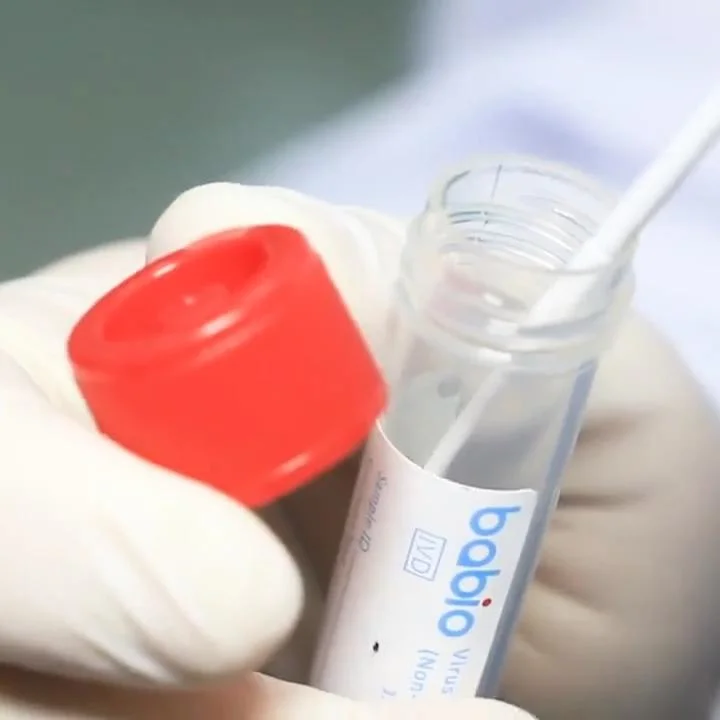 Nucleic Acid Sampling Tube Medical PCR Rapid Tests Sampling Extraction