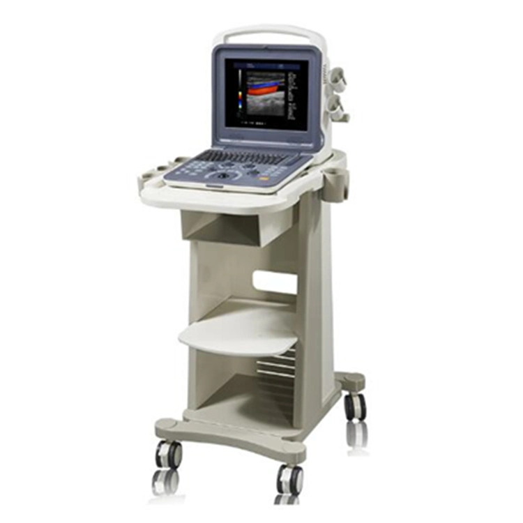 Tragbarer Ultraschallscanner Farbdoppler-Ultraschallscanner Echokardiographie-Maschine