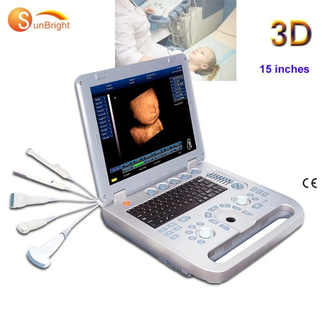 Ultraschall Tragbare Mobile Portable 3D Ultraschall verwendet medizinische Laptop Ultraschall