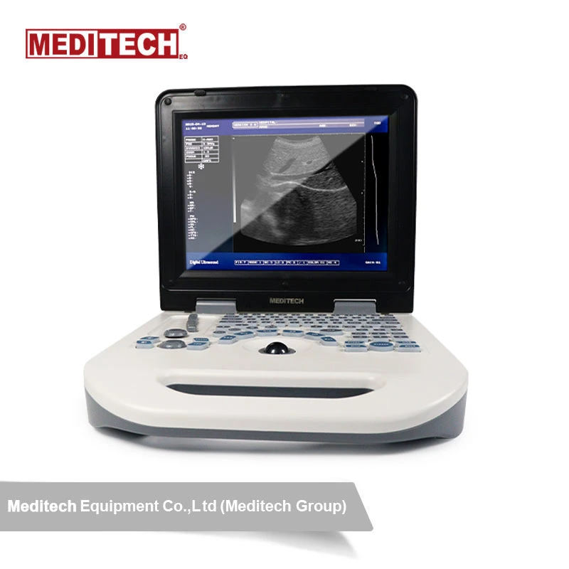 Medical Device B/W Ultrasound Scanner Display USB Port to Transfer Data