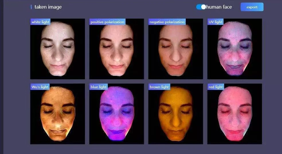 2022 Nova chegada Skin Analyzer Teste rosto facial pele Máquina Máquina de teste de análise