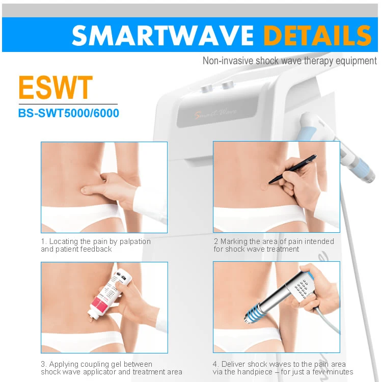 BS-Swt6000 أفضل علاج صدمة خارجي بالموجات فوق الصوتية العمودية (ESWT) يبلغ 5 بار