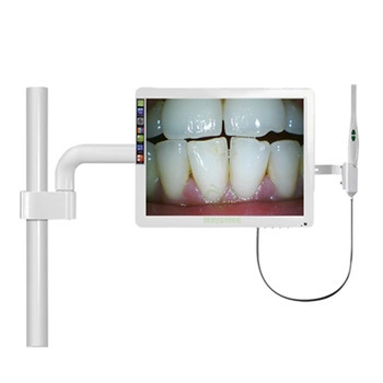 Oral Endoscope All-in-One Standard Dental Endoscope Medical Endoscope