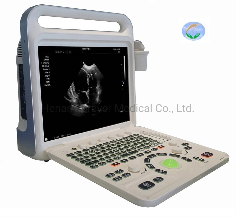 High End Laptop Color Doppler Ultrasound Diagnostic System with Low Price