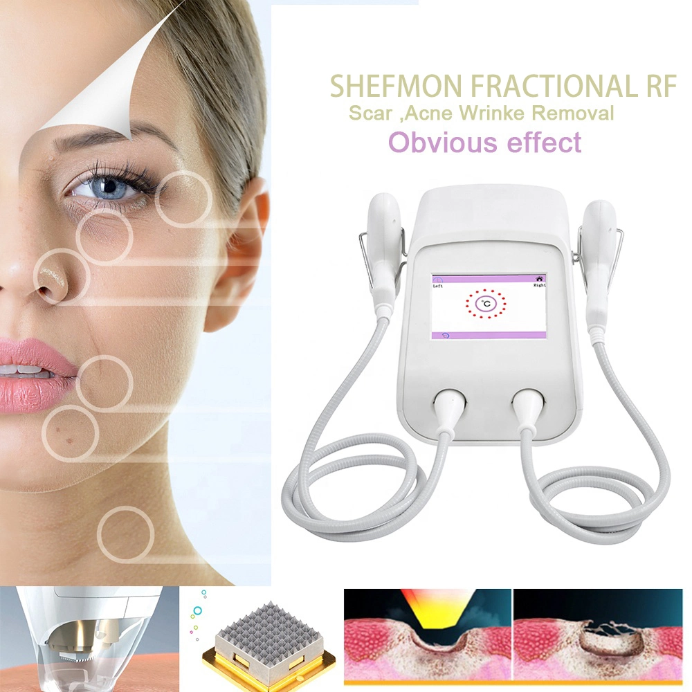 Radio Frequency Skin Tightening RF Microneedling Wrinkle Removal Face Body