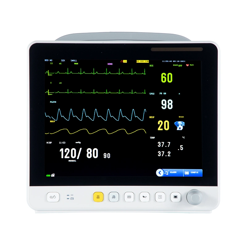 Soymed Multiparameter Patient Monitor Instrument Veterinary Parameter with Cheap Price