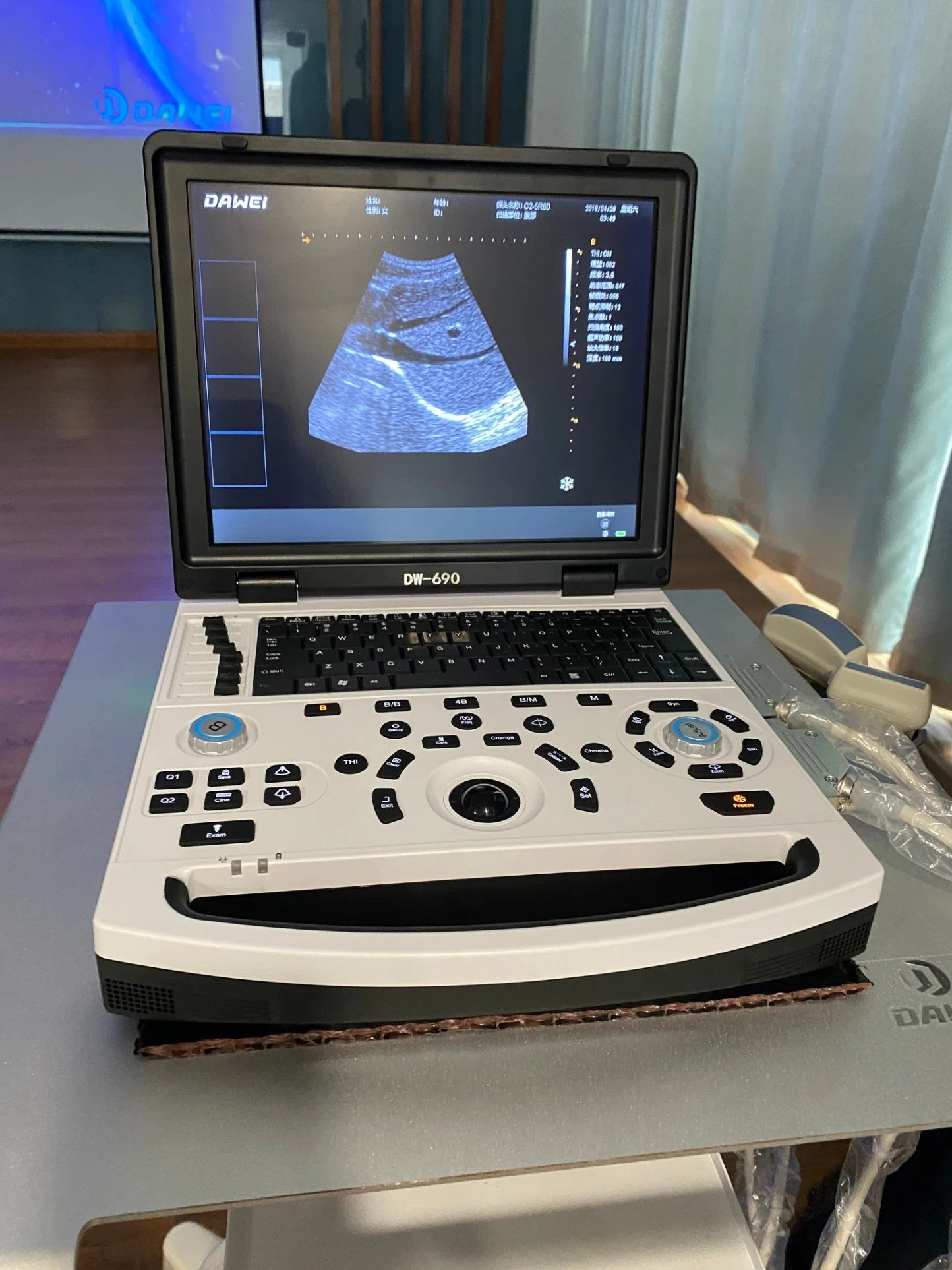 Cutting-Edge Smart Laptop Echo Medical Device for Hospital