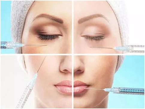 Hyaluronic Acid Gel Filler Injectable Dermal Filler for Face Wrinkle Injection