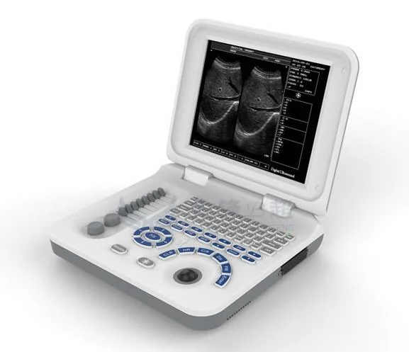 Black and White 10 Inch Tabe Top LED Ultrasound Scanner