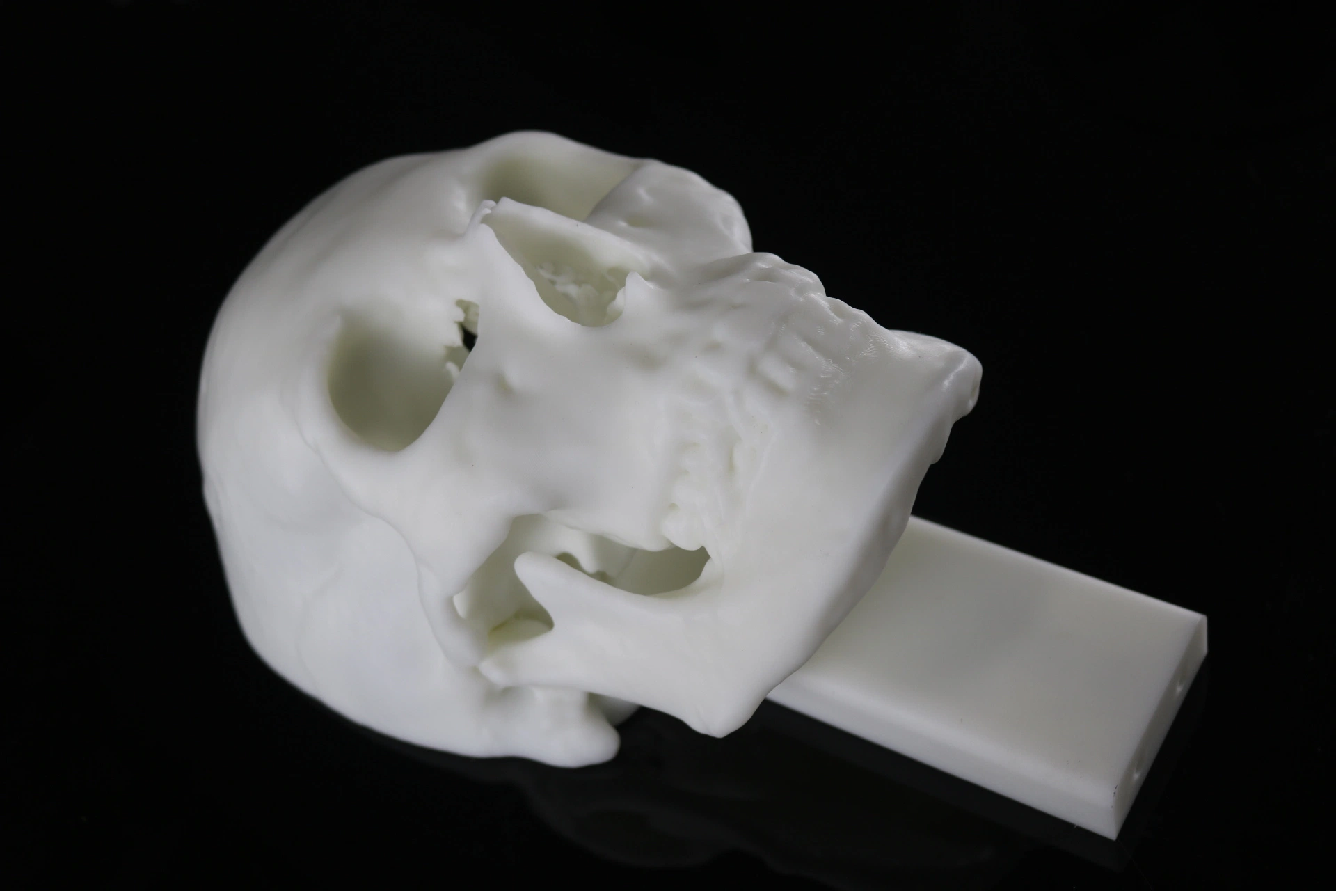 3D impresión SLA material resina cráneo Planificación preoperatoria, médica