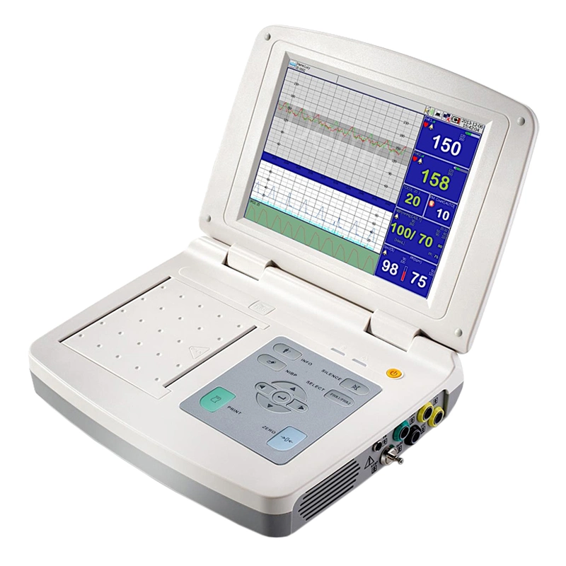 Hospital 10.4 Inches Medical Infant Detection Diagnosis Portable Ctg Fetal Doppler Monitor