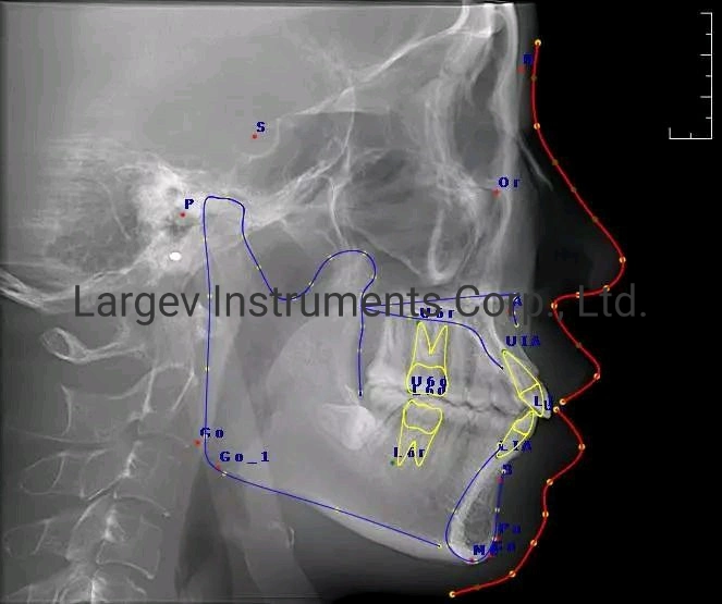 Hires 3D Dental Cbct Professor Xray Scanner 3D Image Examination of Root Cannal 160 150 Fov