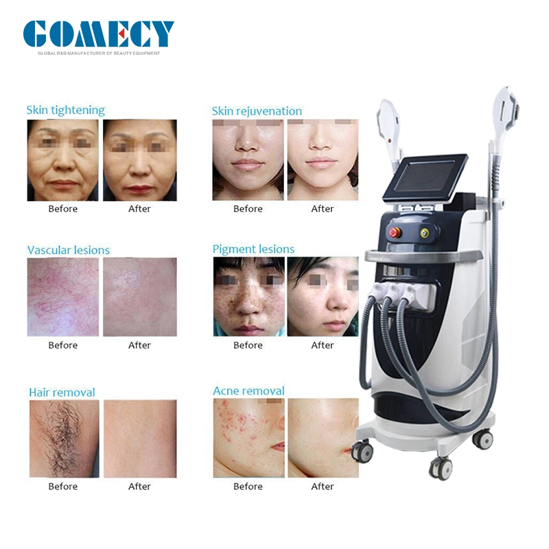 Painless Permanent IPL Opt Laser Hair Removal Beauty Equipment