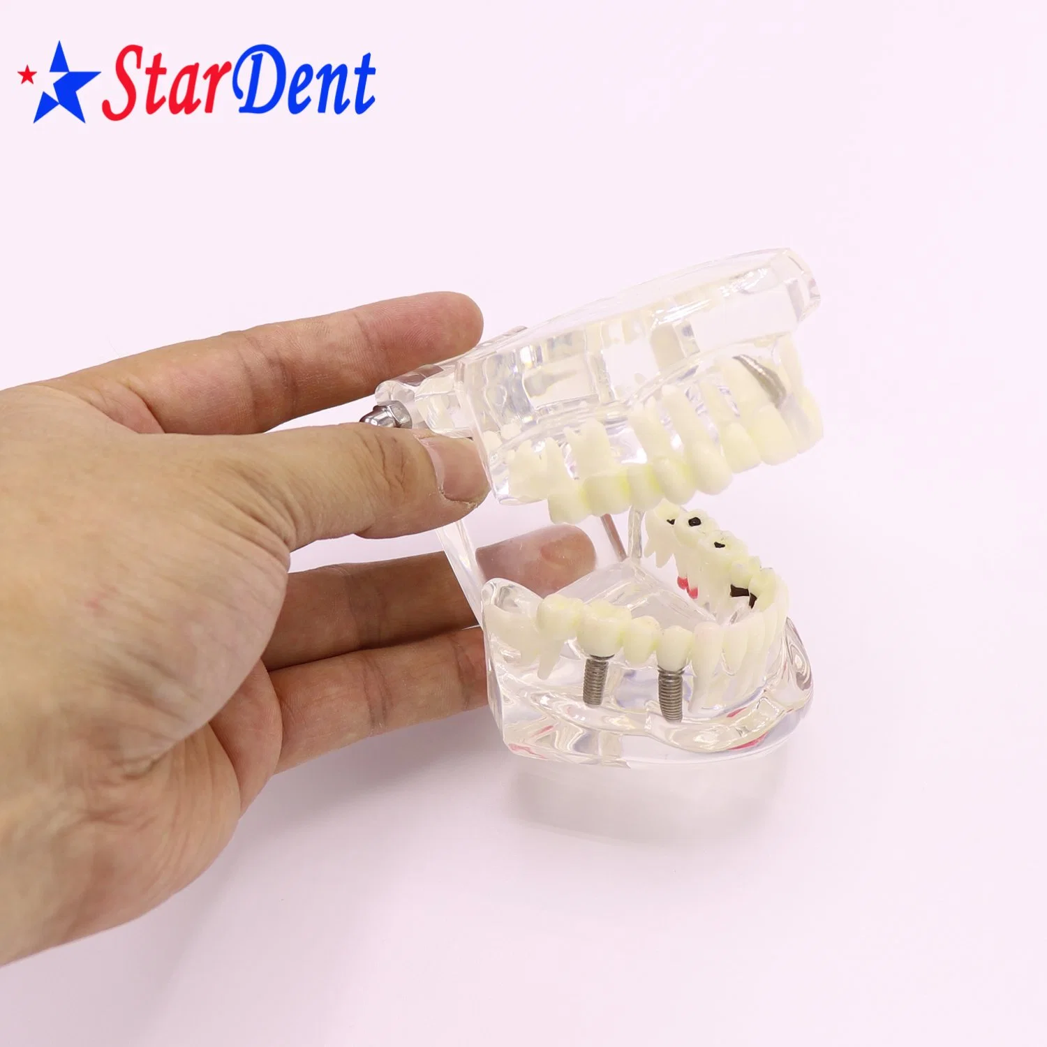 Transparent Adult Pathology Dental Model, Dental Teaching Model Teeth Model