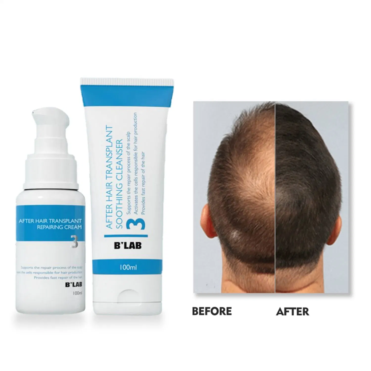 Private Label Natural Head Scalp Care Product After Hair Transplant Repairing Cream