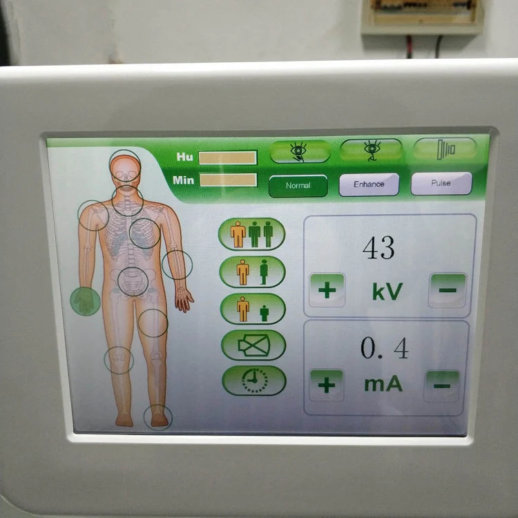 Medical Mobile C-Arm Xray Fluoroscopy System for Orthopedics Surgical