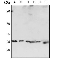 HP1 alpha anticorps polyclonal