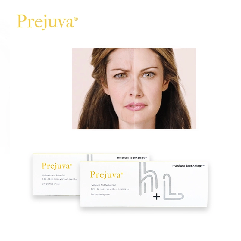 Prejuva Profílo Filler Injection Face Lift 2ml ácido Hialurónico piel Refuerzo