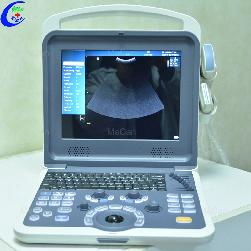 Full Digital Color Doppler Ultrasound Diagnostic System Portable Ultrasound