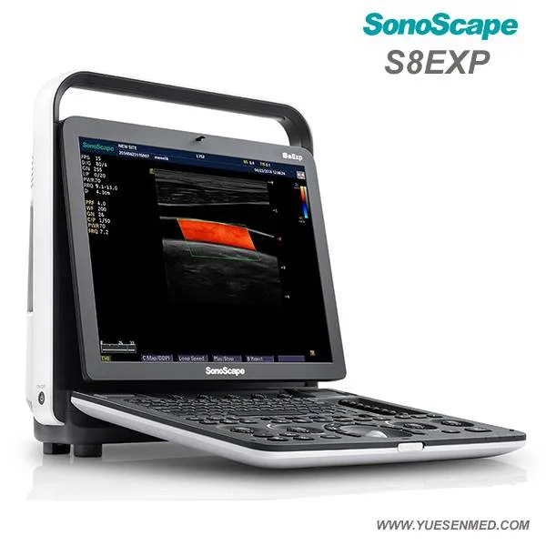 Sonoscape S8expv escáner de ultrasonidos veterinarios