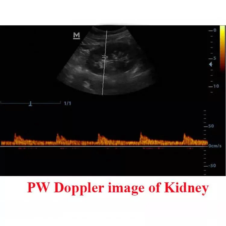 Оригинал Mindray Dp-20 Bw портативные ультразвуковые устройства