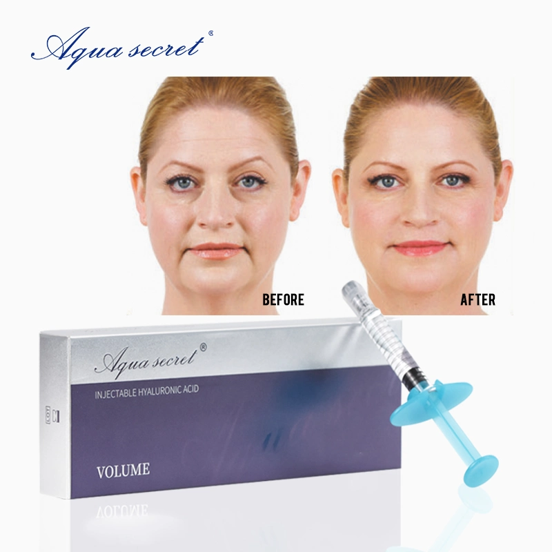 Aqua Secret 1ml 2ml Non Animal Cross Linked Hyaluronic Acid Dermal Filler Injection for Face Hyaluronic Acid Injection