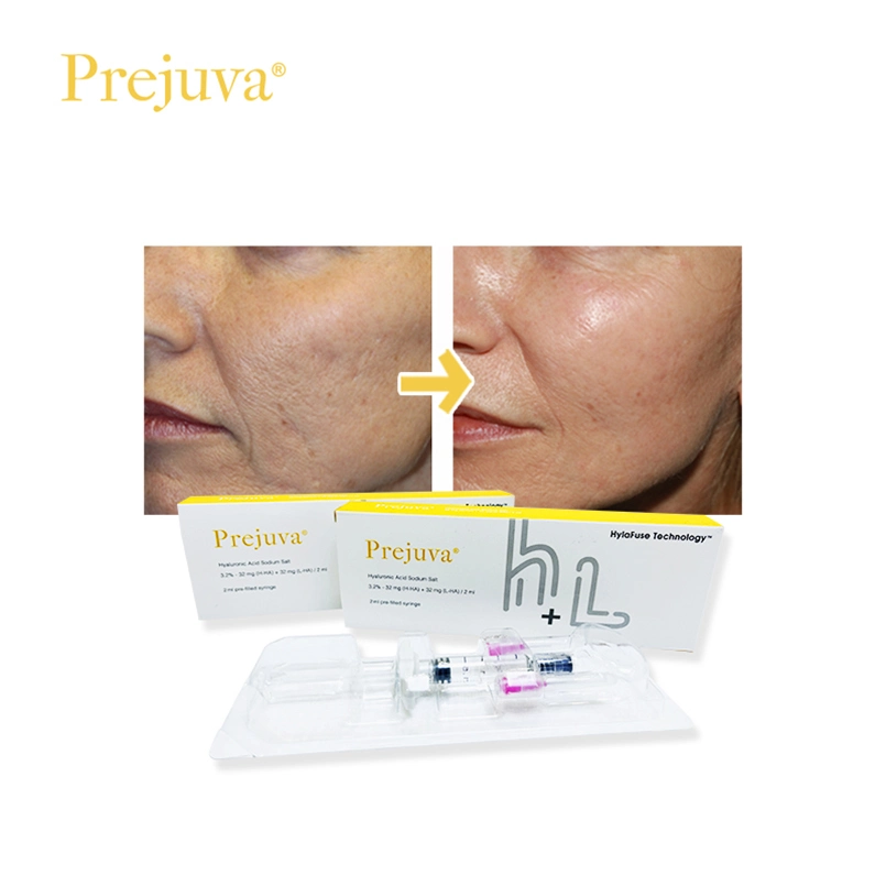 Prejuva Profílo Filler Injection Face Lift 2ml ácido Hialurónico piel Refuerzo