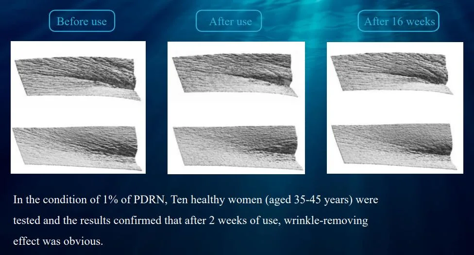 مادة Pdrn PN الخام شبه كاملة للجمال المنتج Salmon DNA GMP قياسي