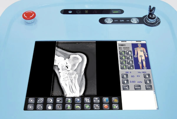 High Frequency 200mA Mobile Digital Radiography System X-ray Machine Plx5200