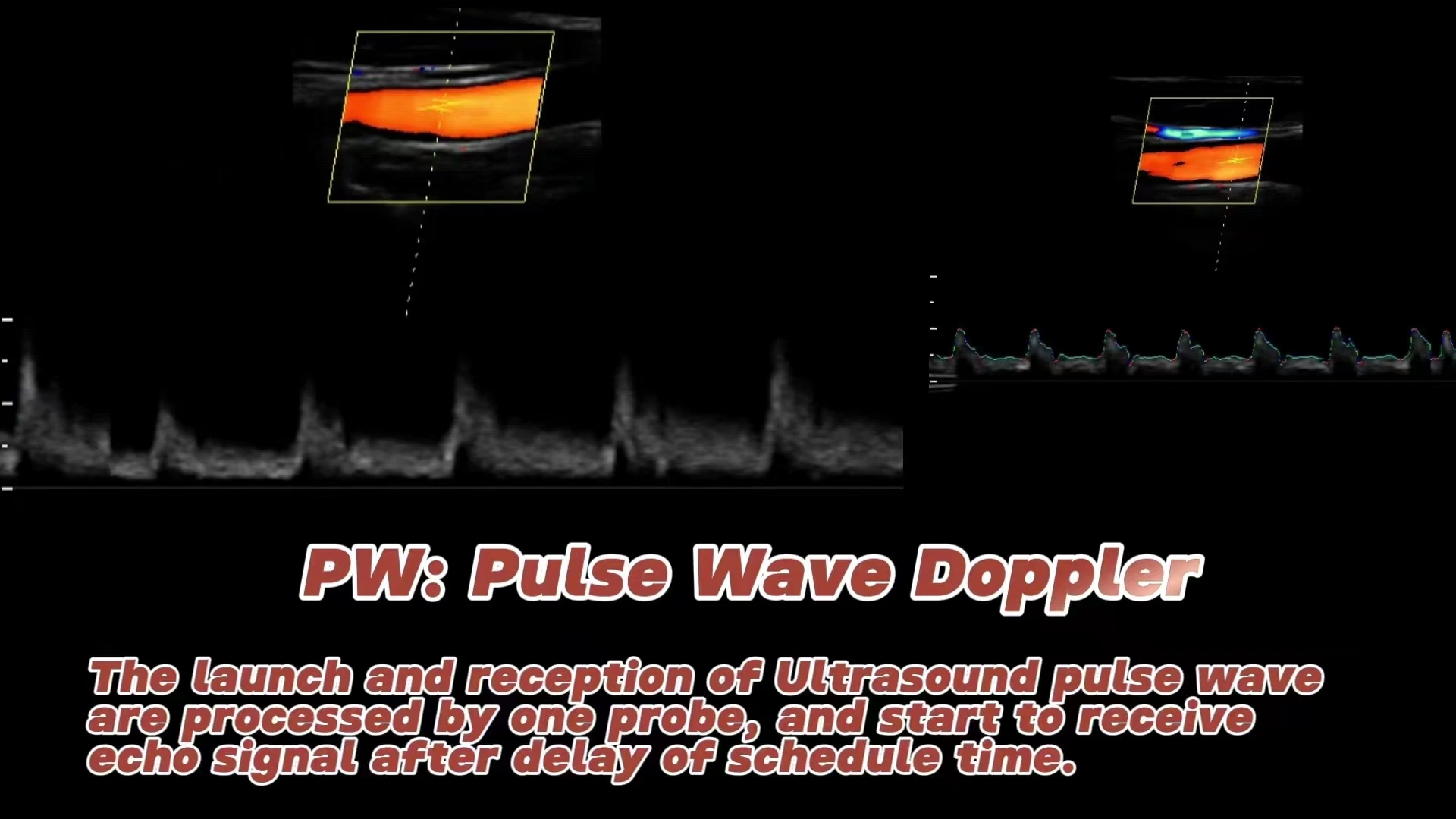 Trolley Color Doppler K10 Similar with Mindray