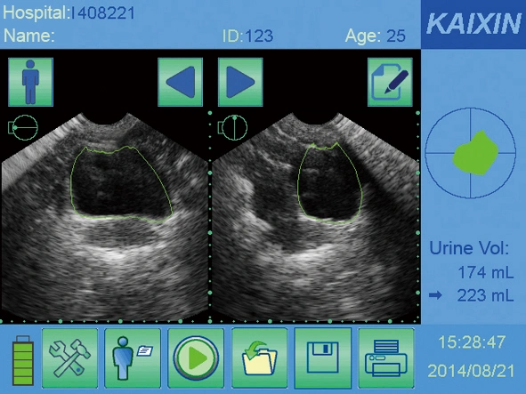 Chinese Factory Supply Noninvasively Urine Scanner Bladder Volume Tester