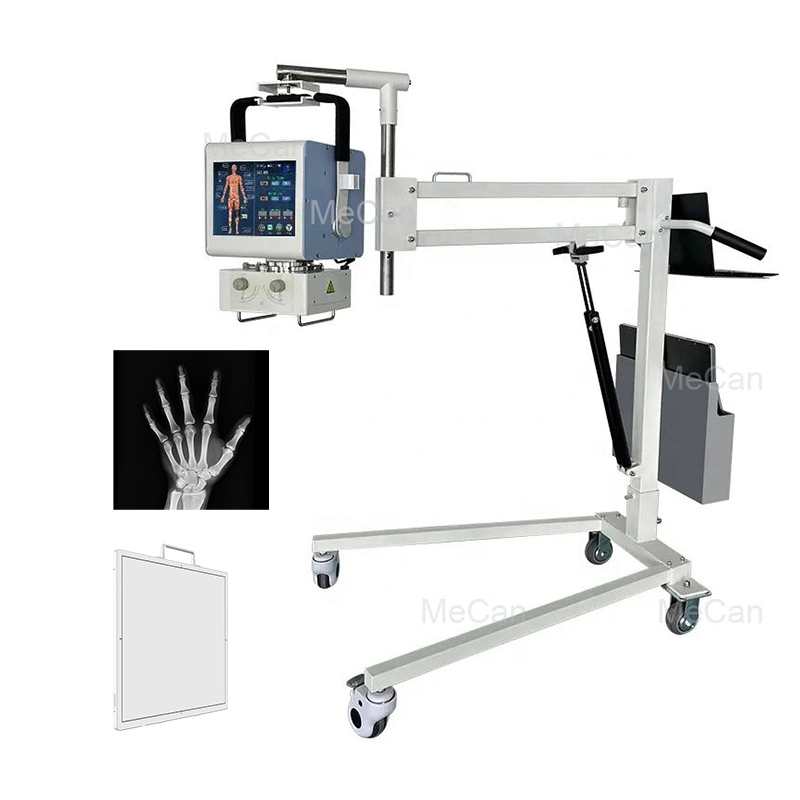 X Ray Equipment Patient Portable X-ray Machine for Hospital