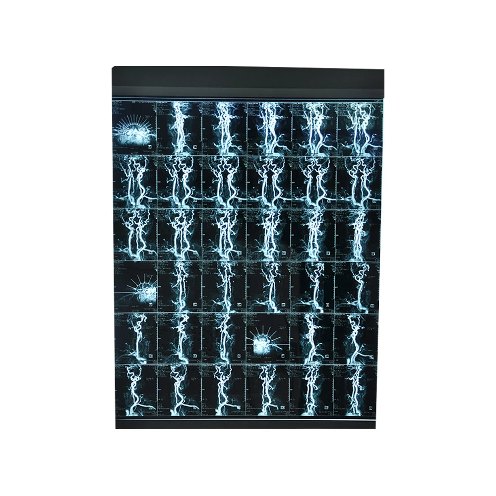 Impresión médica Radiología Universal Dry Film / 14*17 pulgadas Medical Película térmica azul/impresora de rayos X.