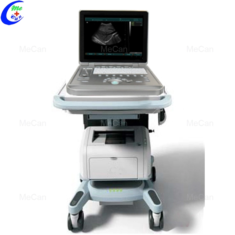 Sonoscape S30 Mejor Imagen 3D/4D Ultrasonido Doppler en Color con Carro