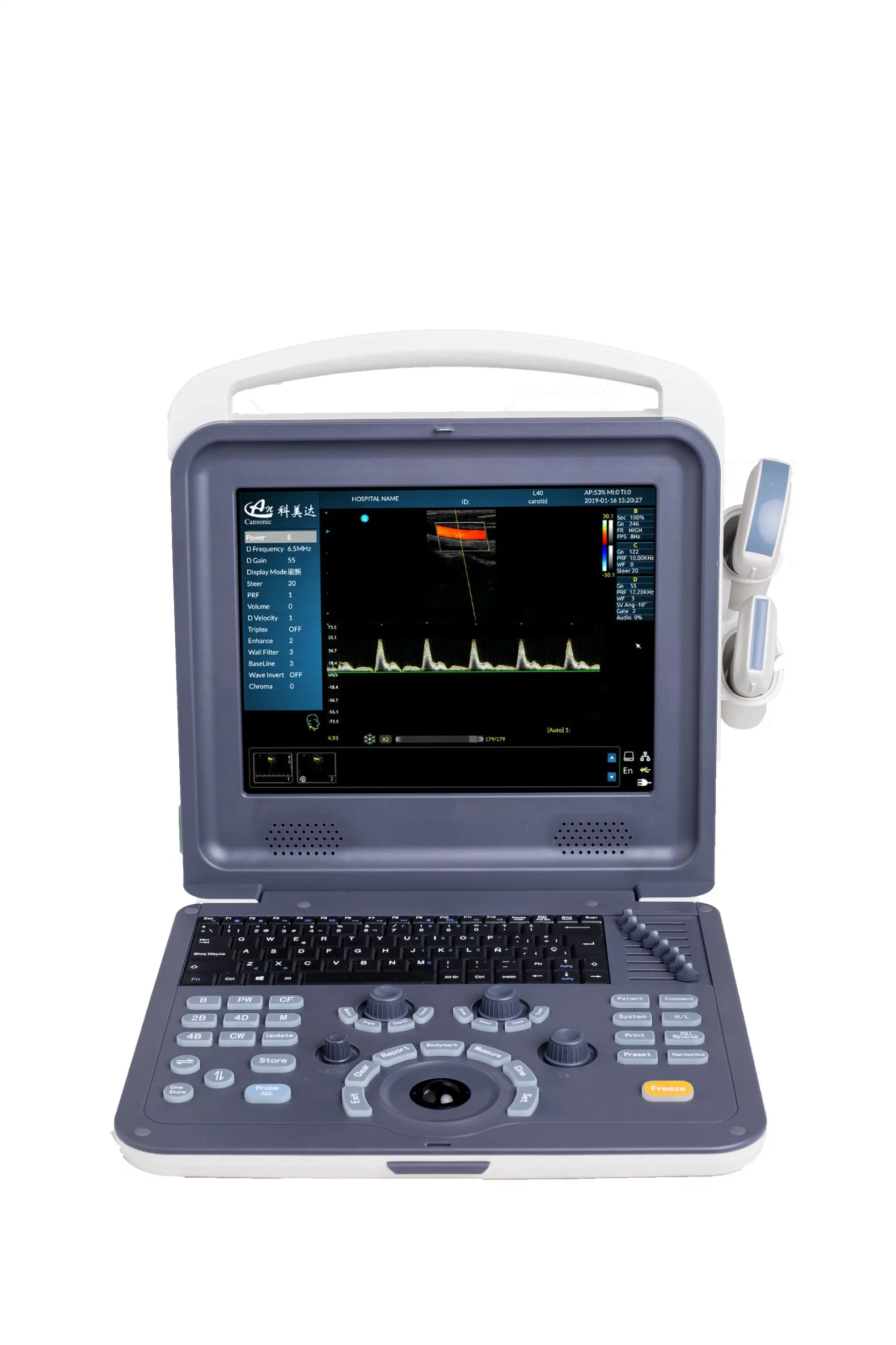 Portable Color Doppler Ultrasound Scanner for Female K0