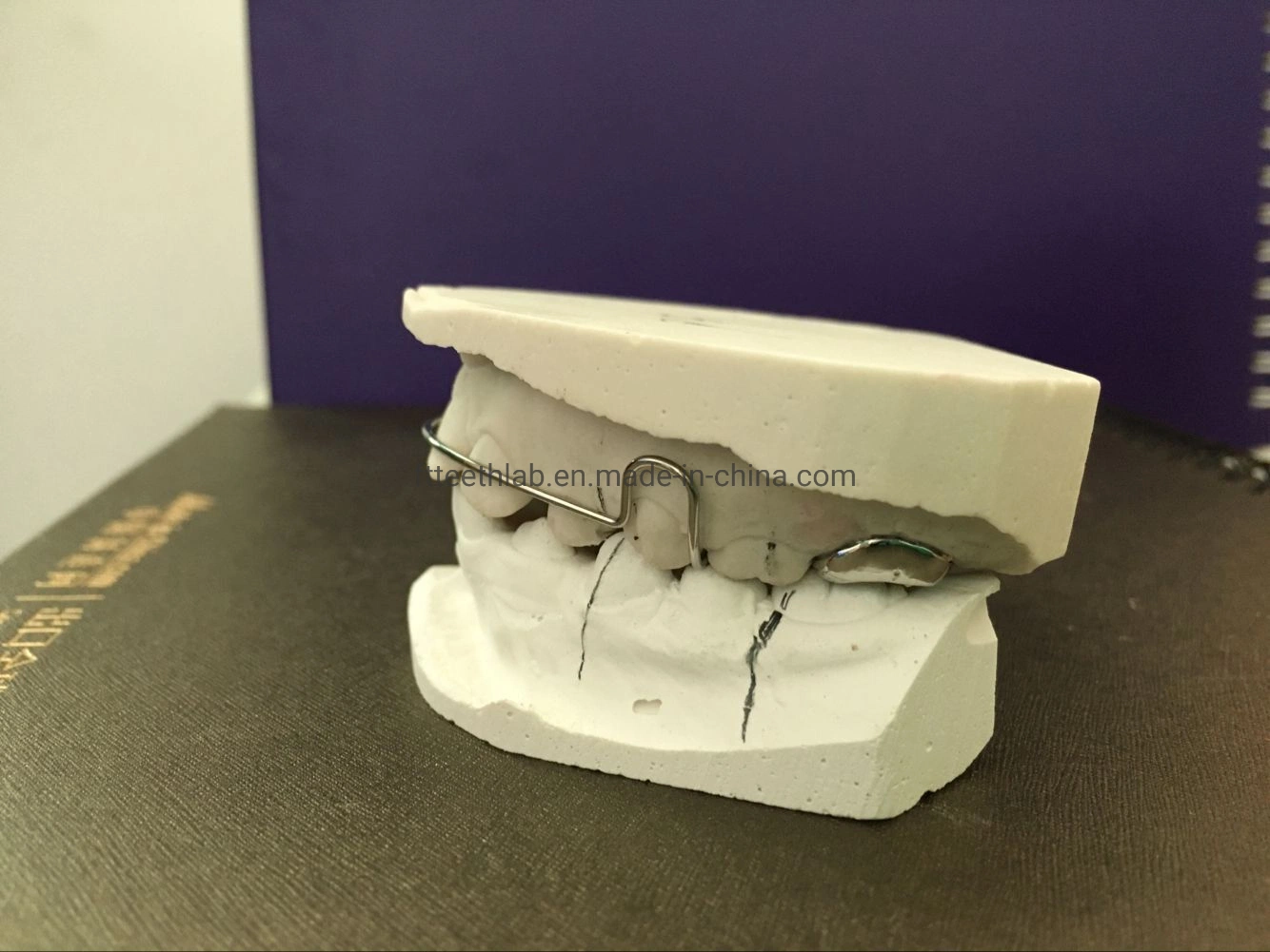 Habit Breaker Thumb Appliance From China Dental Lab