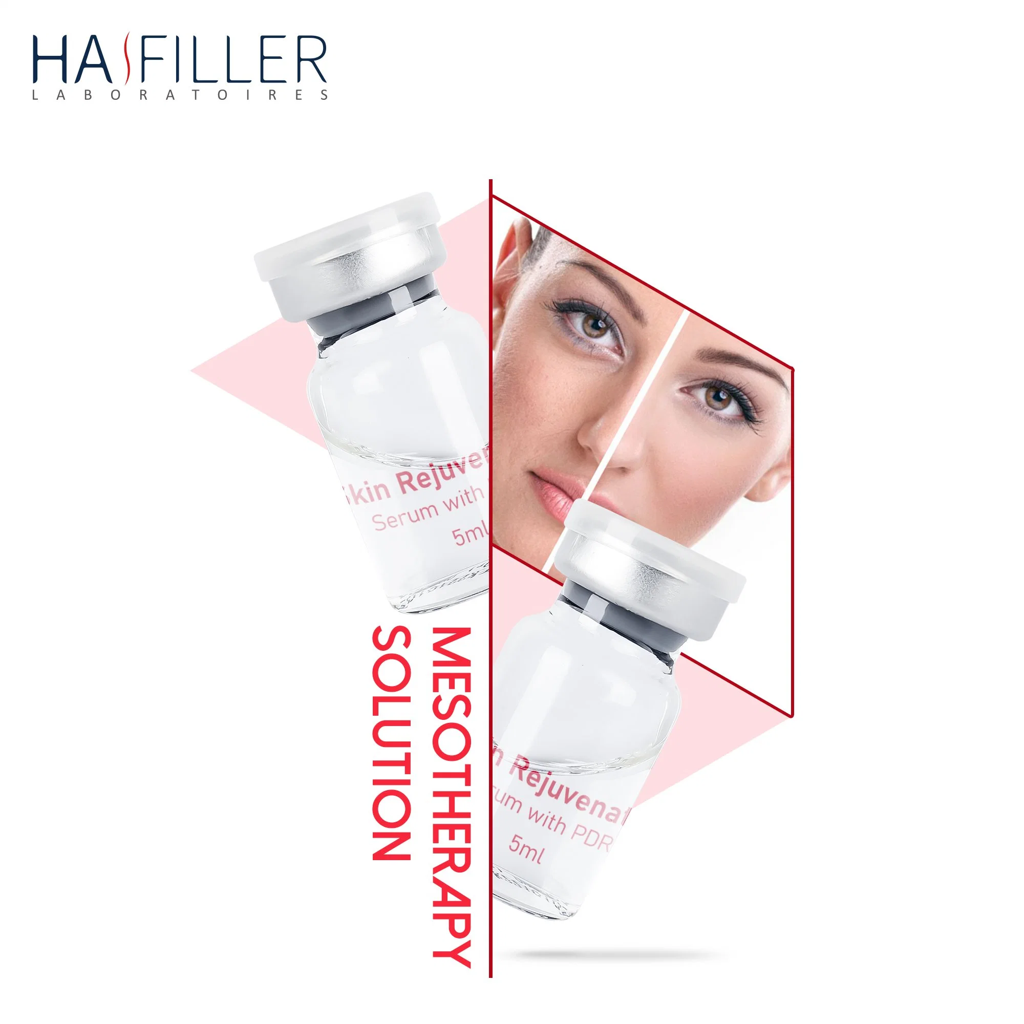 Großhandel/Lieferant Haut Verjüngen Serum Enthalten Pdrn Anti Aging Skinbooster Hyaluronic Acid Pdrn Injektionslösung Für Mesotherapie