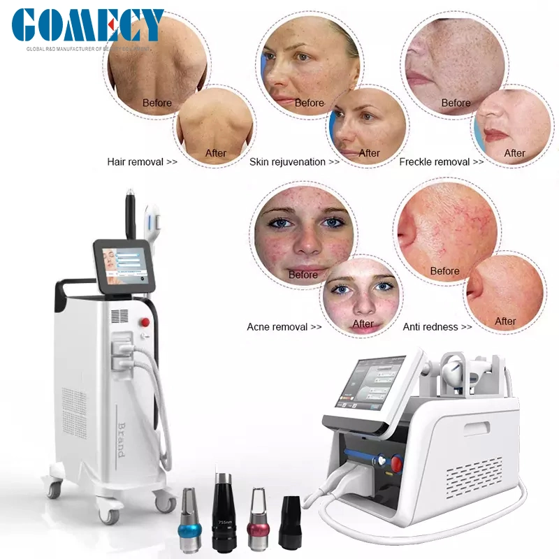 2023 New Dpl+Pico Laser 2 in 1 Machine Double System for Hair Removal Tattoo Removal Machine