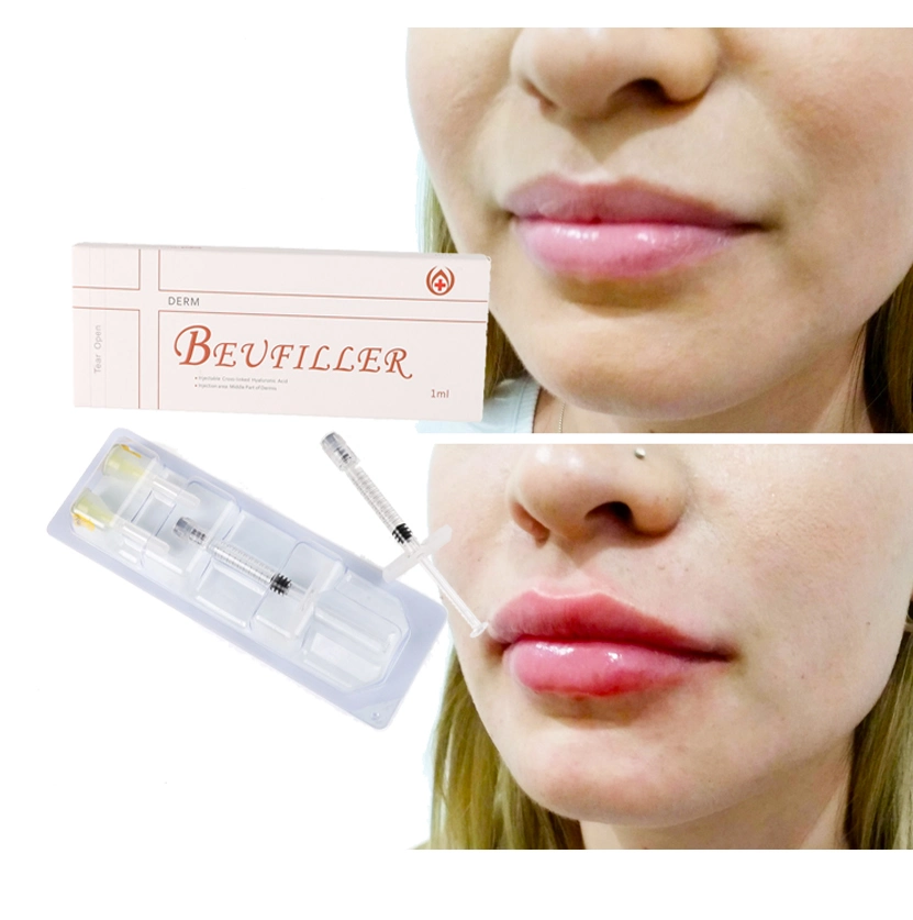 CE Beufiller Hyaluronsäure-Füllstoff Injektionsmittel Dermalfüller 2ml Ha Füllstoff Lip Breast Füllstoff