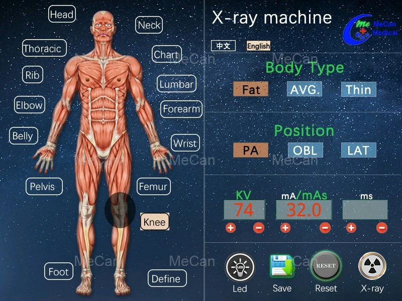 Radiography Chest Machine Other Radiology Equipment Radiographe Ray X Portable with Cheap Price