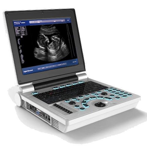 Laptop Ultrasound Scanner for Human & Veterinary Xf30b