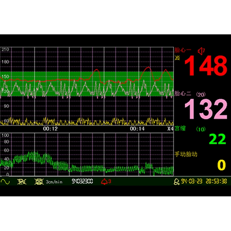 Медицинских электронных Cardiotocograph доплеровского плода детский монитор частоты сердечных сокращений