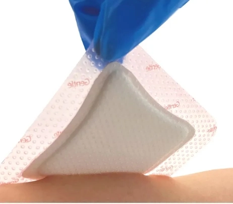 Medical Hydrogel Wound Dressing Hypoallergenic, High Viscosity, Hemostatic, Antibacterial, Breathable