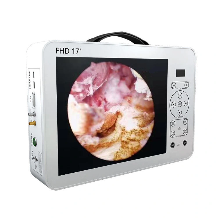 Medical Ent Endoscopy Equipment Digital Surgical Fiberscope Portable HD Ent USB Endoscope Camera