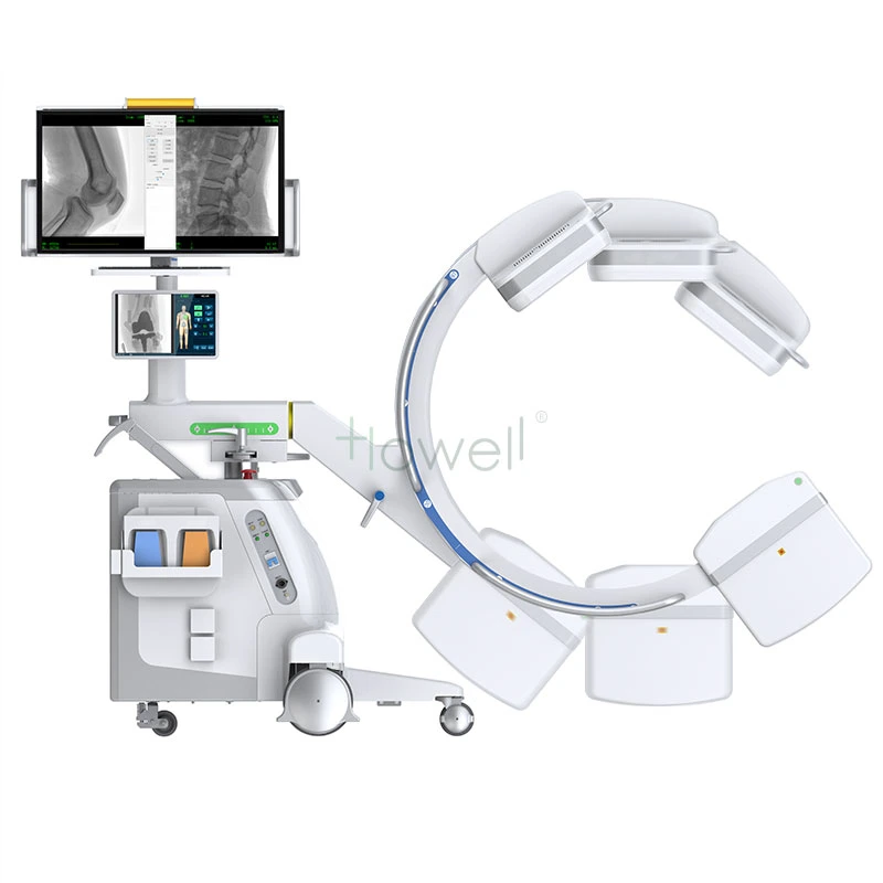 Orthopedic C-Arm Machine Ortho Compact Mobile C-Arm Image System