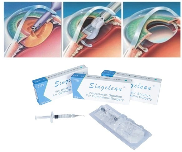 Biofermented Sodium Hyaluronate Surgical Supplies Materials Singclean Glaucoma Viscolastic Solution