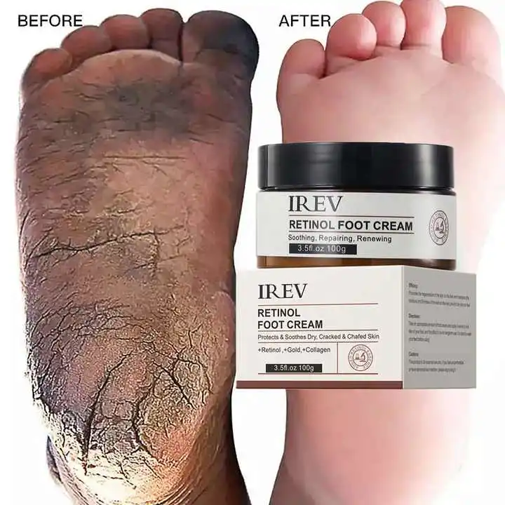 Natural Crack Heel Repair Collagen Milk Dry Dead Removal Whitening Foot Care Cream